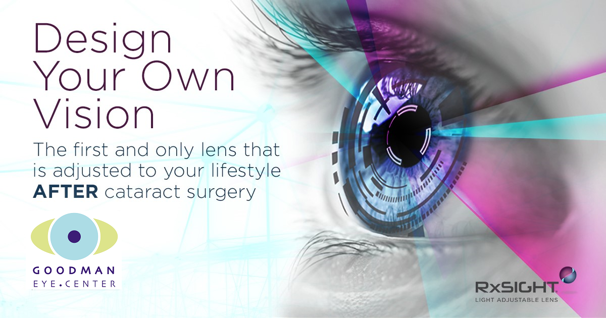 Cataract Surgery San Francisco LightAdjustable Lens Goodman Eye